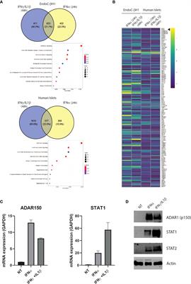 ADAR1-dependent editing regulates human β cell transcriptome diversity during inflammation